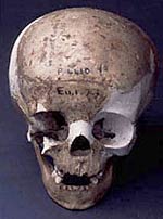 Young boy’s skull from Mother Grundy’s Parlour. © 2000 The Manchester Museum, The University of Manchester.